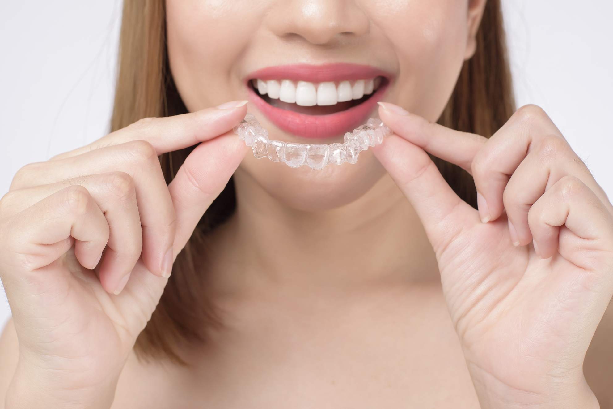 Invisalign Elastics Explained  Savina Dental Clinics (Malta & Gozo)